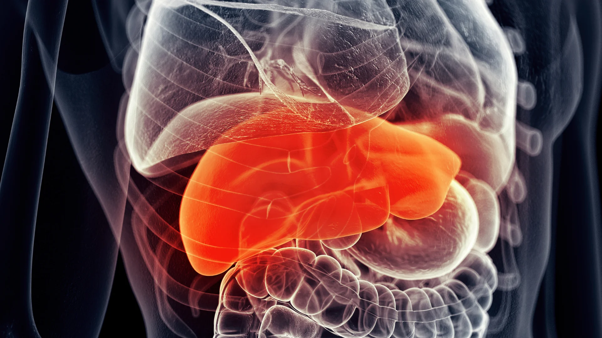Liver Cancer
